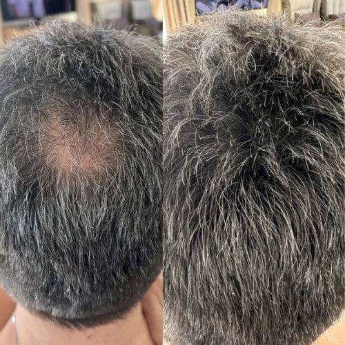Alpha Men Hair. premium keratin hair building fibers for men with thinning hair