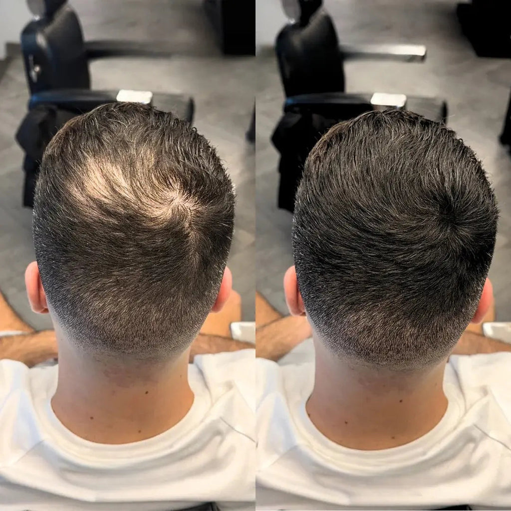 Alpha Men Hair. premium keratin hair building fibers for men with thinning hair