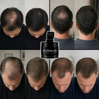 Alpha Men Hair. premium keratin hair building fibers for men with thinning hair